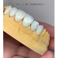 深圳MYY 假牙出口德國(guó)專線，假牙出口歐洲 套筒冠